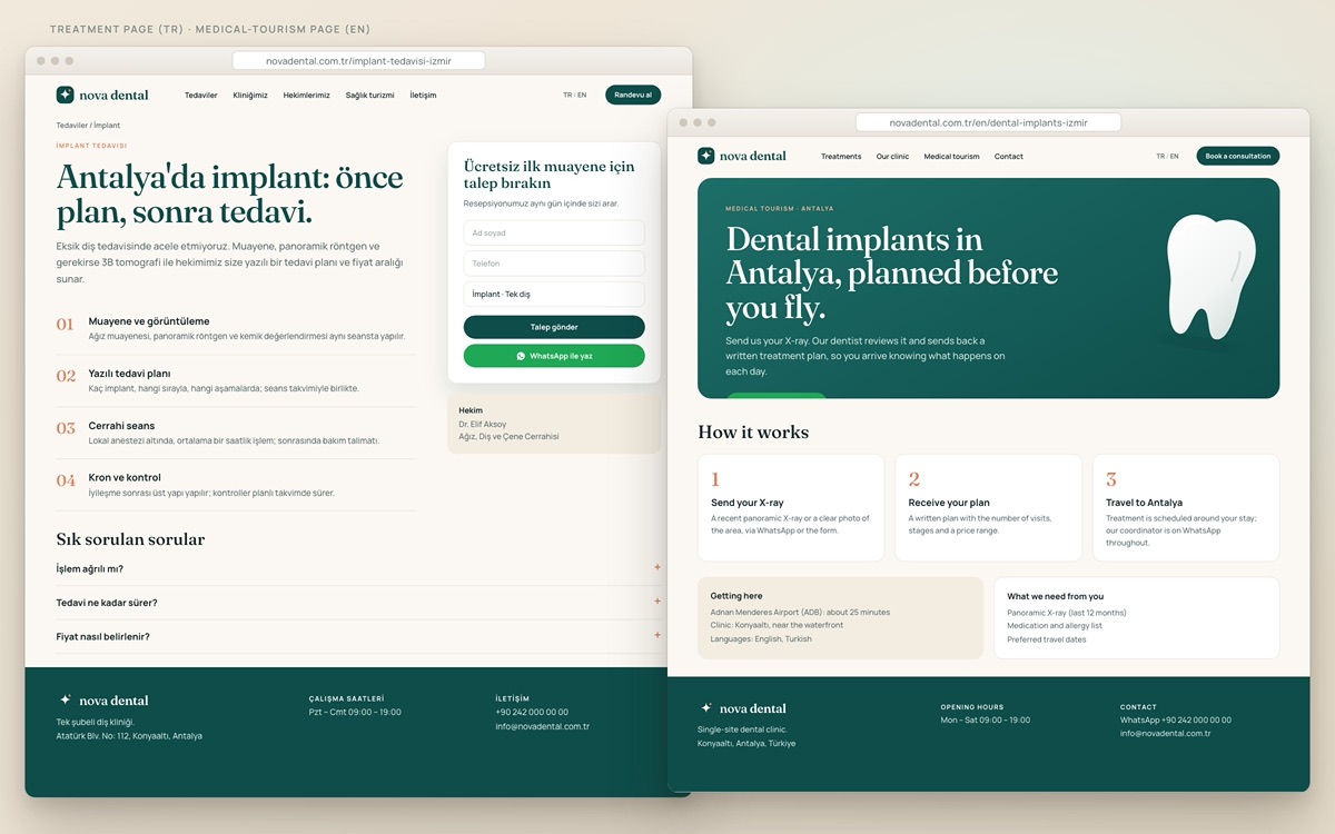 Nova Dental — Implant treatment page and the English medical-tourism page